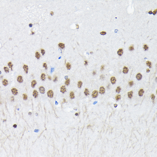 Anti-PTBP2 Antibody (CAB6054)