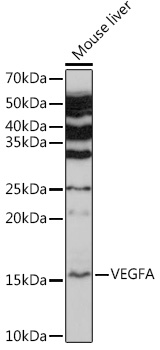 Anti-VEGFA Antibody (CAB17000)