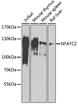 Anti-NFATC2 Antibody (CAB14189)