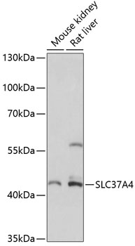 Anti-SLC37A4 Antibody (CAB14564)