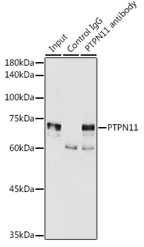 Anti-PTPN11 Antibody [KO Validated] (CAB12486)