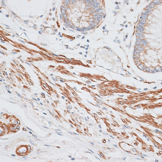 Anti-GRK5 Antibody (CAB3899)