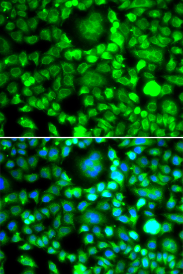 Anti-BLID Antibody (CAB7275)