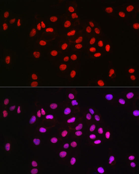 Immunofluorescence analysis of U2OS cells using MCM2 Rabbit mAb at dilution of 1:100 (40x lens). Blue: DAPI for nuclear staining.