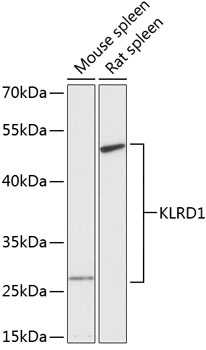 Anti-KLRD1 Antibody (CAB13622)