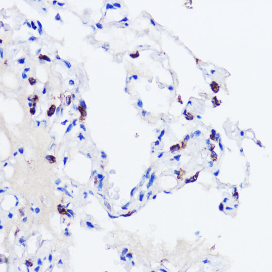 Anti-SFTPC Antibody (CAB1835)