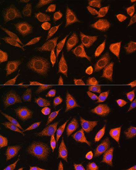 Anti-CNOT1 Antibody (CAB5969)