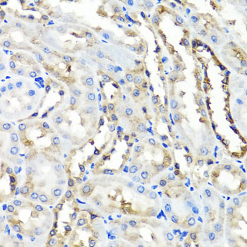 Anti-HYAL1 Antibody (CAB6623)