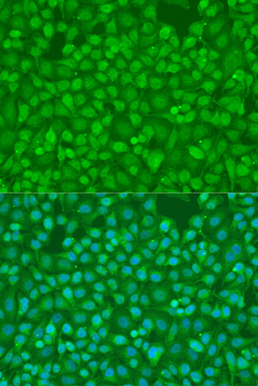 Anti-Smad7 Antibody (CAB1051)