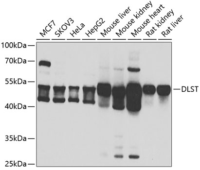 Anti-DLST Antibody (CAB6901)