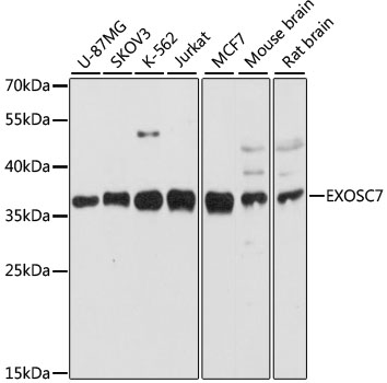 Anti-EXOSC7 Polyclonal Antibody (CAB9689)