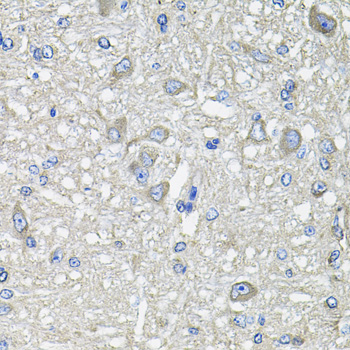 Anti-GFPT1 Antibody (CAB3882)