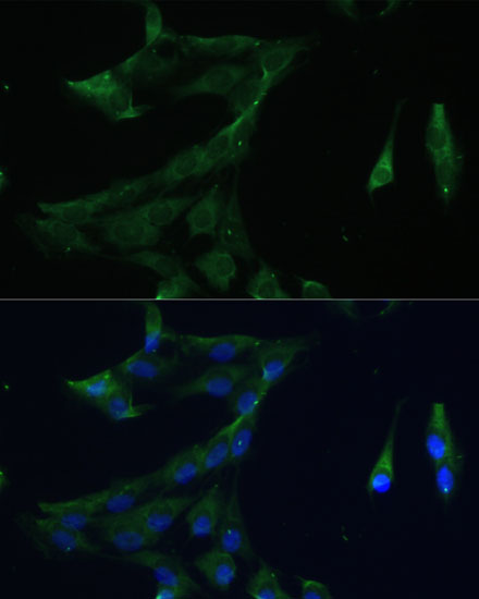 Anti-ARL3 Antibody (CAB16348)