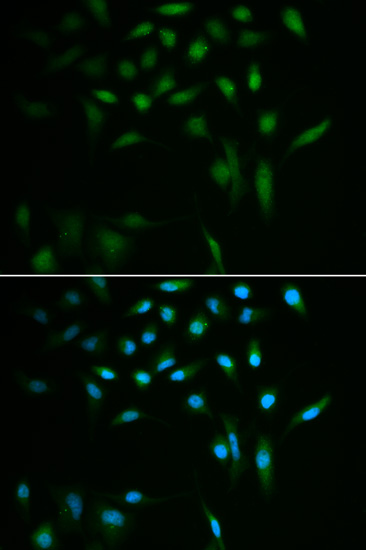 Anti-SUMO3 Antibody (CAB3099)