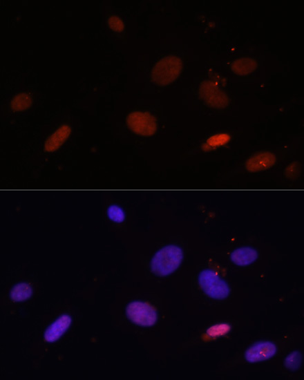 Anti-Histone H1.0 Antibody (CAB6918)