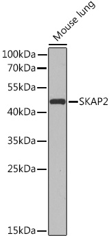 Anti-SKAP2 Antibody (CAB15750)