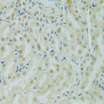 Anti-RCC1 Antibody (CAB6350)