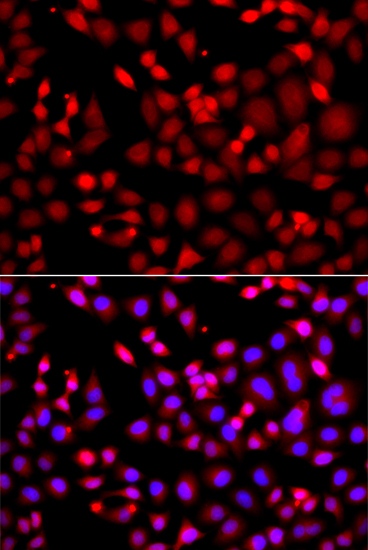 Anti-MTUS1 Antibody (CAB13437)