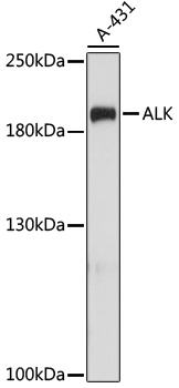 Anti-ALK Antibody (CAB0766)