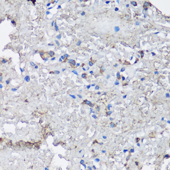 Anti-NLRC4 Antibody (CAB13117)