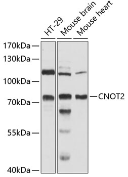 Anti-CNOT2 Antibody (CAB12832)