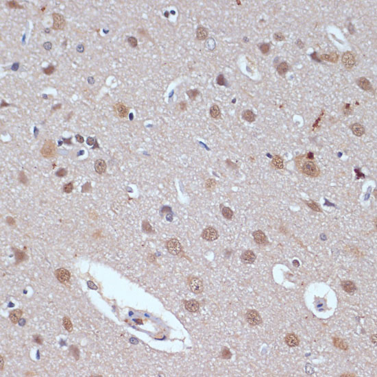 Anti-TP53BP2 Antibody (CAB5704)