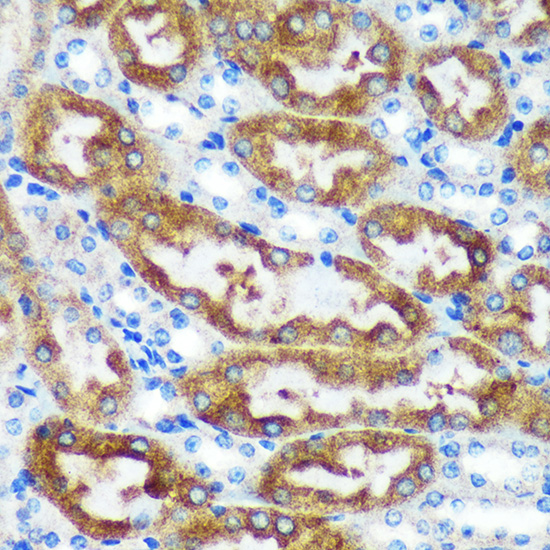 Anti-CHCHD2 Antibody [KO Validated] (CAB16645)