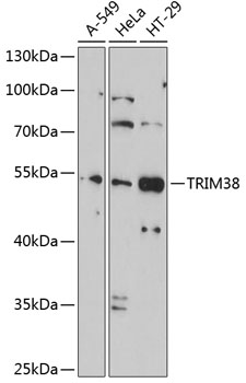 Anti-TRIM38 Antibody (CAB2600)