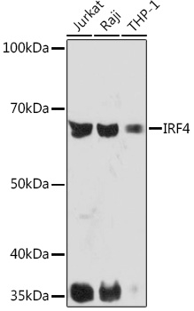 Anti-IRF4 Antibody (CAB5215)