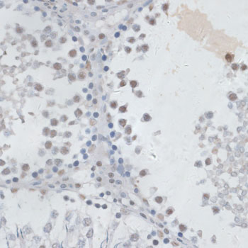 Anti-USP7 Antibody (CAB13565)