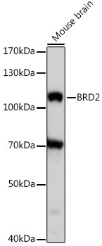 Anti-BRD2 Antibody (CAB16241)