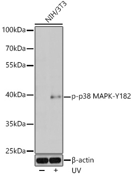 Anti-Phospho-MAPK14-Y182 Antibody (CABP0057)