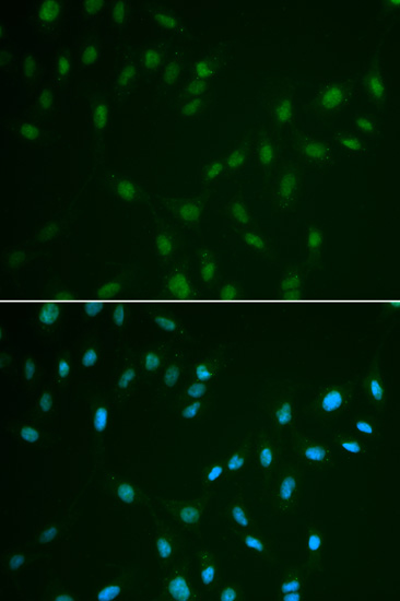 Anti-HSF2 Antibody (CAB2747)