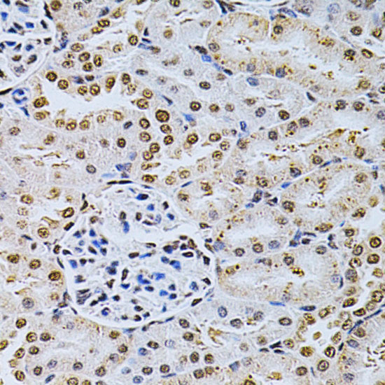 Anti-MDM2 Antibody (CAB0345)