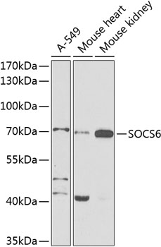 Anti-SOCS6 Polyclonal Antibody (CAB9957)