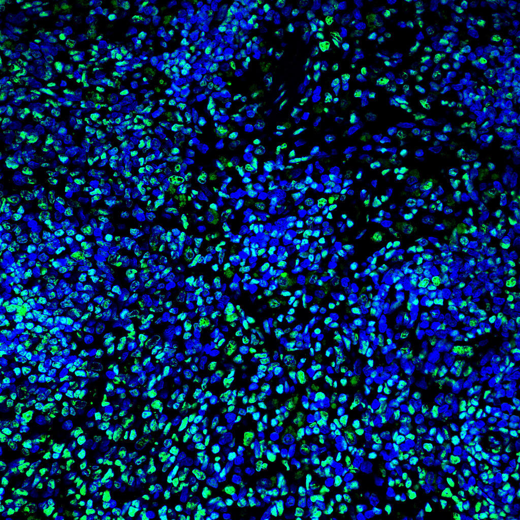 Paraffin embedded mouse spleen was treated with DNase I to fragment the DNA. DNA strand breaks showed intense fluorescent staining in DNase I treated sample (green). The cells were counterstained with DAPI (blue). This photo was taken by confocal microscope.