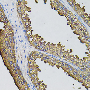 Anti-SUMO3 Antibody (CAB3099)