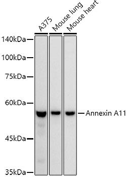 Western blot analysis of extracts of various cell lines, using Annexin A11 antibody at 1:1000 dilution. Secondary antibody: HRP Goat Anti-Rabbit IgG (H+L) at 1:10000 dilution. Lysates/proteins: 25ug per lane. Blocking buffer: 3% nonfat dry milk in TBST. Detection: ECL Basic Kit. Exposure time: 3s.