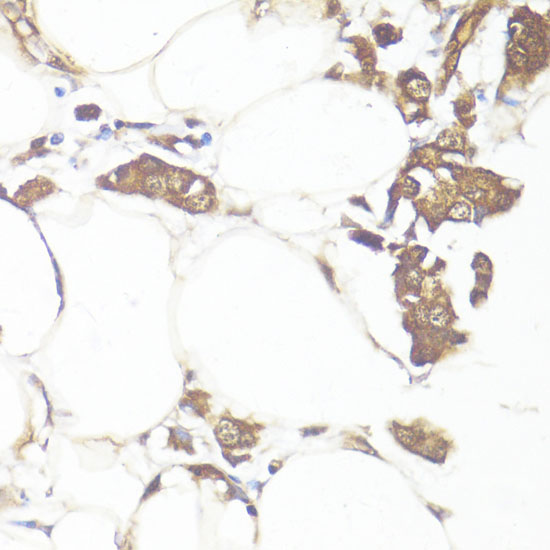 Anti-Smad7 Antibody (CAB16396)