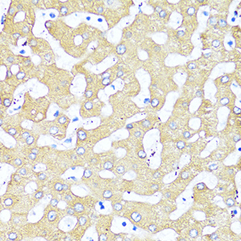 Anti-TGFB2 Antibody (CAB16226)