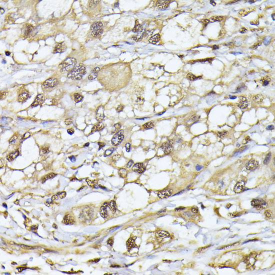 Anti-PSMB3 Polyclonal Antibody (CAB9947)