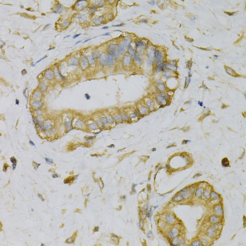 Anti-EIF4B Antibody (CAB5405)