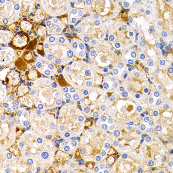 Anti-TFF1 Antibody (CAB1789)