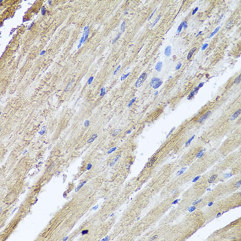 Anti-PIK3C2A Polyclonal Antibody (CAB8526)