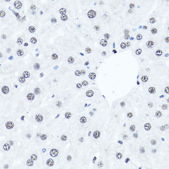 Anti-Symmetric DiMethyl-Histone H4-R3 Antibody (CAB3159)