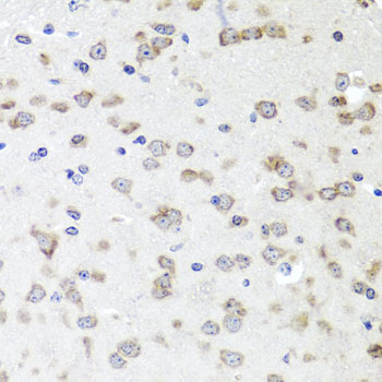 Anti-IGFBP5 Antibody (CAB12451)