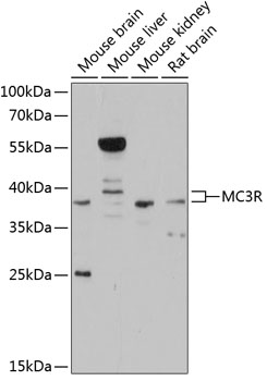 Anti-MC3R Antibody (CAB11609)