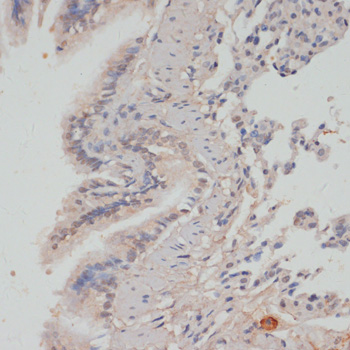 Anti-Phospho-PPP1CA-T320 pAb (CABP0786)