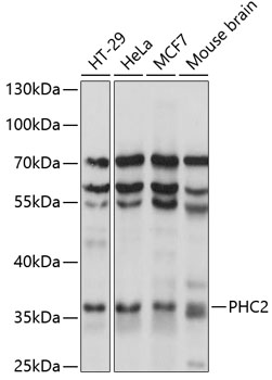 Anti-PHC2 Antibody (CAB14727)