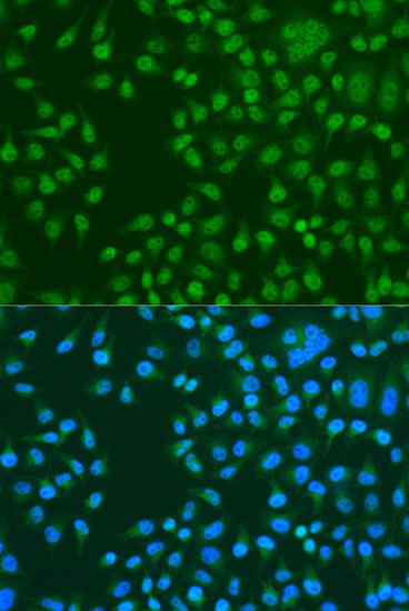 Anti-KAT5 Antibody (CAB1678)